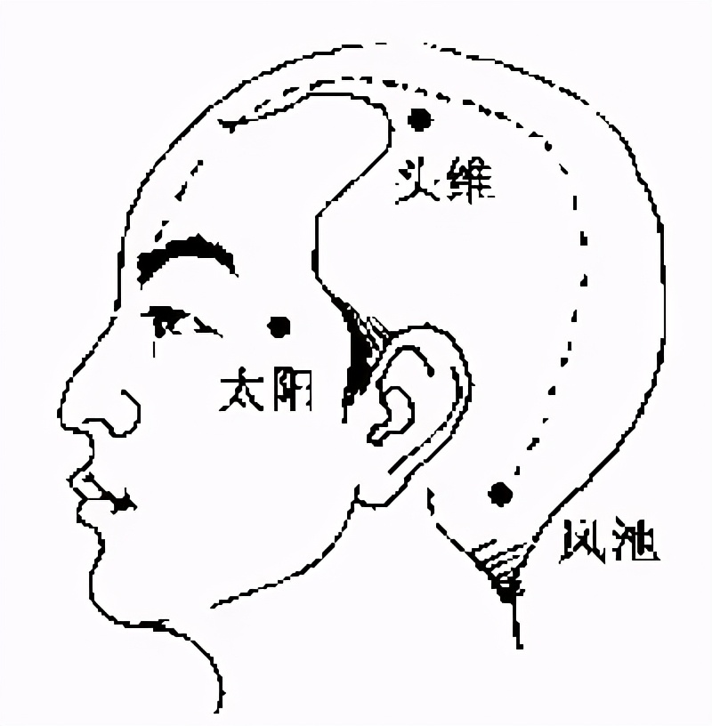 太秃头了怎么办,如何解决头顶秃