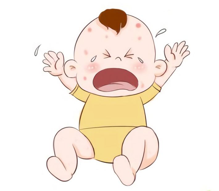 迎接二胎系列五｜婴儿湿疹