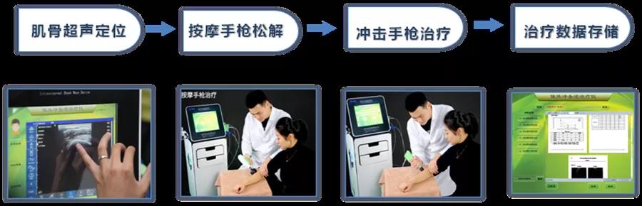 体外冲击波应用,体外冲击波疗法在康复科的应用