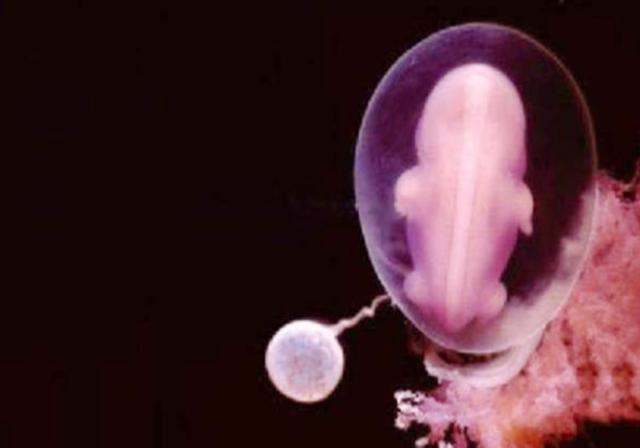 组图*放播**精子和卵子结合全过程，精子：找个媳妇，太难了