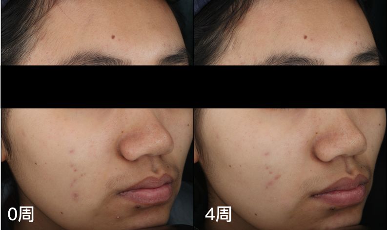 这些大牌护肤品真的值得买吗,盘点平价国货不输大牌护肤品