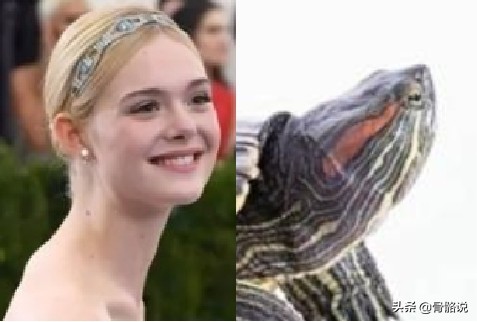 怎么预防脖子有个富贵包,脖子后的富贵包真是夺命包