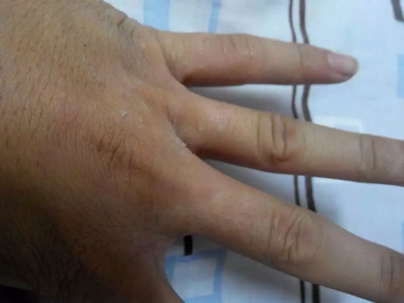 手干燥粗糙手纹深用什么护肤产品,可以改善手纹粗糙的护手霜