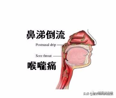 宝宝感冒咳嗽吃什么粥比较有营养,3岁宝宝咳嗽吃什么饭有营养
