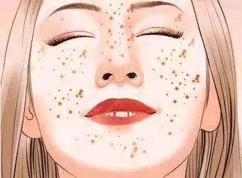 目前治疗褐青斑的最好方法,治疗褐斑最好的药