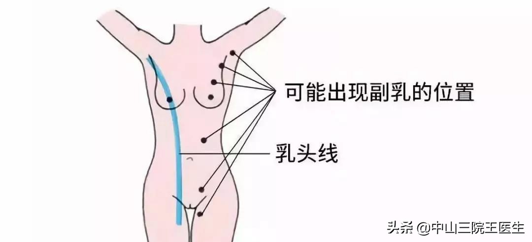 凉快宽松小背心遮副乳,夏季显瘦遮副乳背心