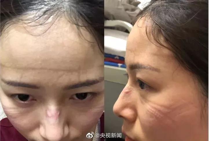 疫情蔓延各大明星,各地迎接抗疫回归医护人员合集