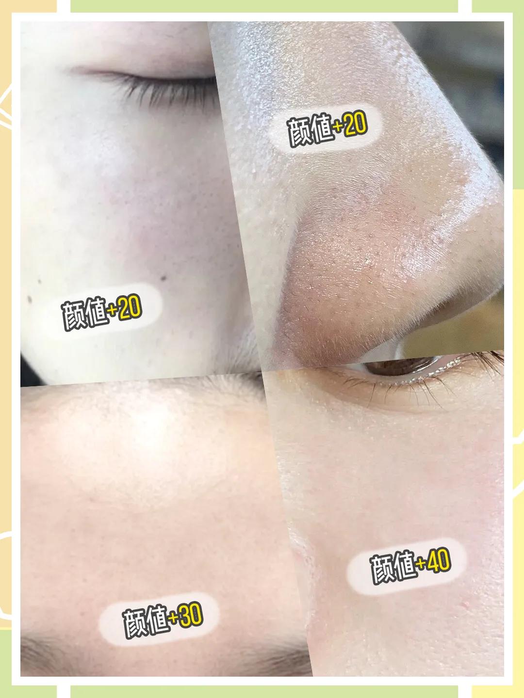 脸蛋两侧长了许多黑头是什么原因,脸蛋年轻貌美