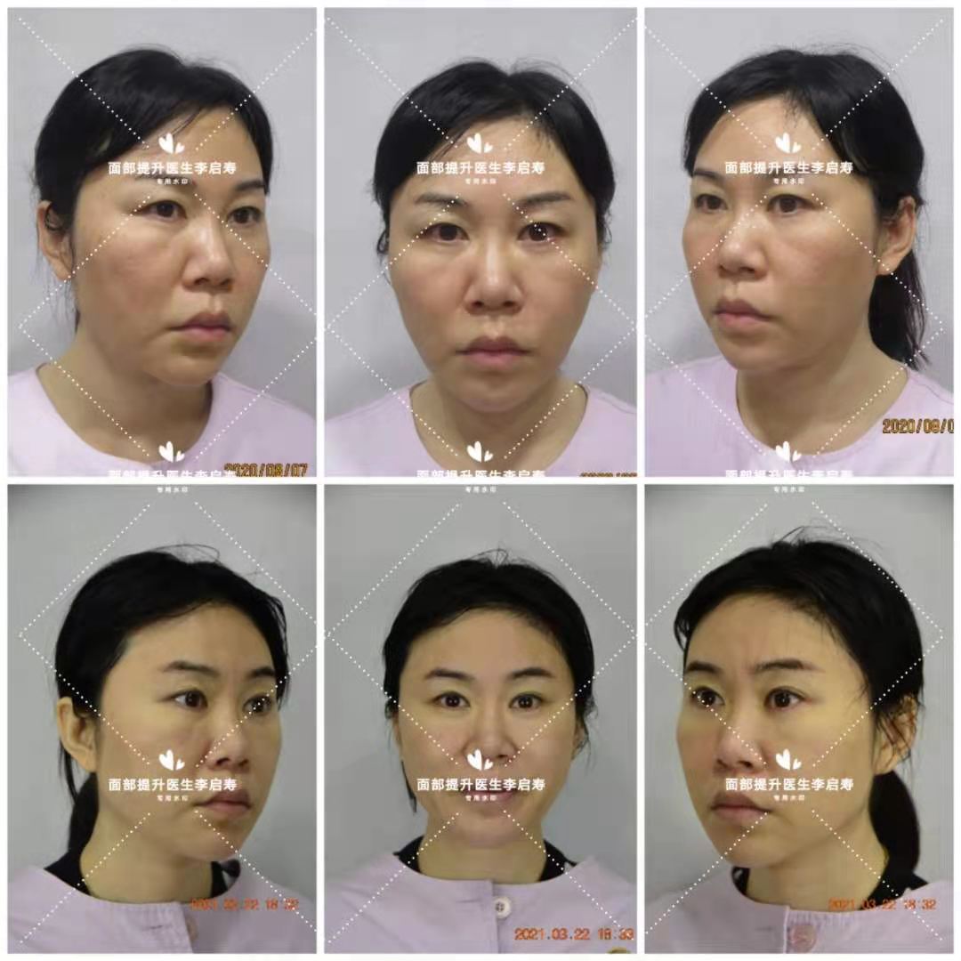 长脸型怎么让脸胖点,长脸型怎么改善变好看