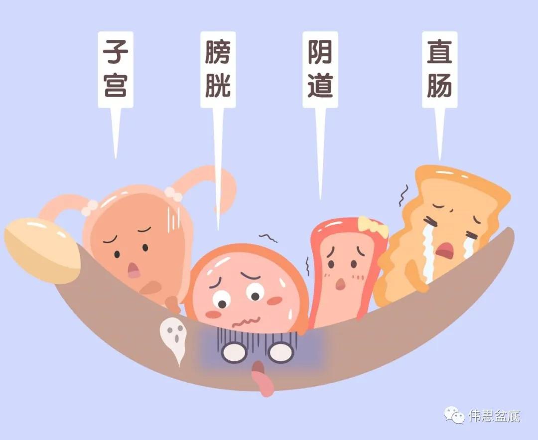 漏斗形尿失禁容易恢复吗,压力性尿失禁和脏器脱垂