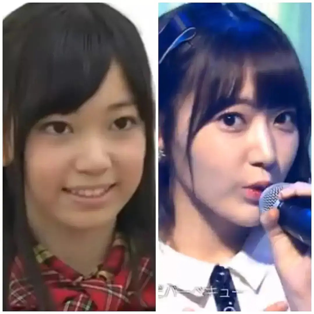 日本整容惊人案例,日本整容是不是最先进