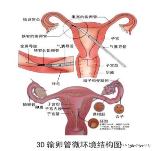 女人不孕不育十大原因,女人不孕不育祖传秘方