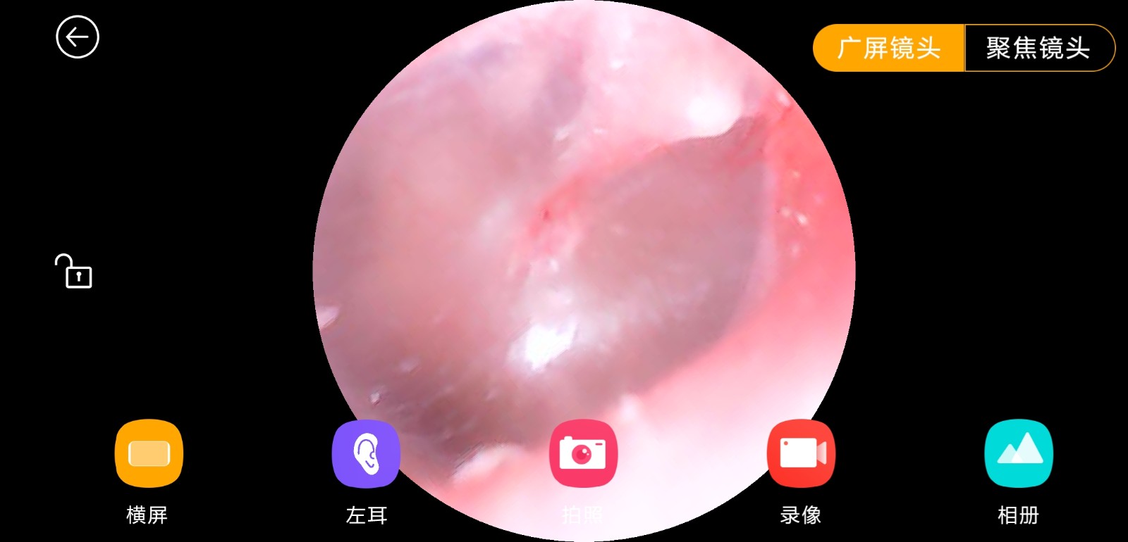 让你能看得见的掏耳朵“粑粑”，蜂鸟智能可视采耳棒M9Pro