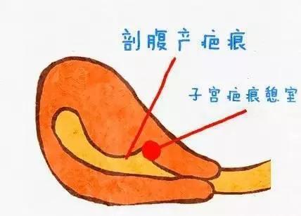 经期延长一般吃什么药好得快,经期延长吃了止血药没用咋办