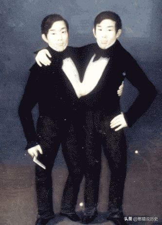 世界上最诡异的双头连体人,两个大脑如何控制同一个身躯