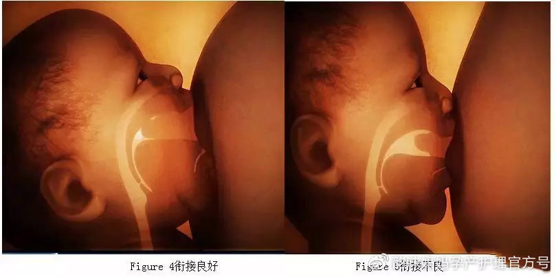 新手宝妈乳房护理,新手妈妈怎么给乳房清洁