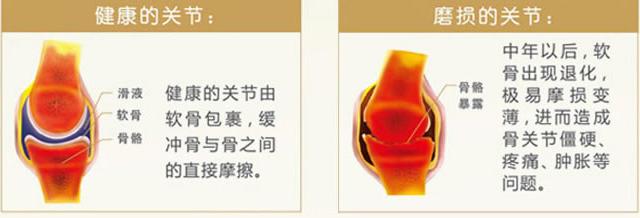 氨糖软骨素钙片的功效和作用,朗迪氨糖软骨素钙片的功效和作用