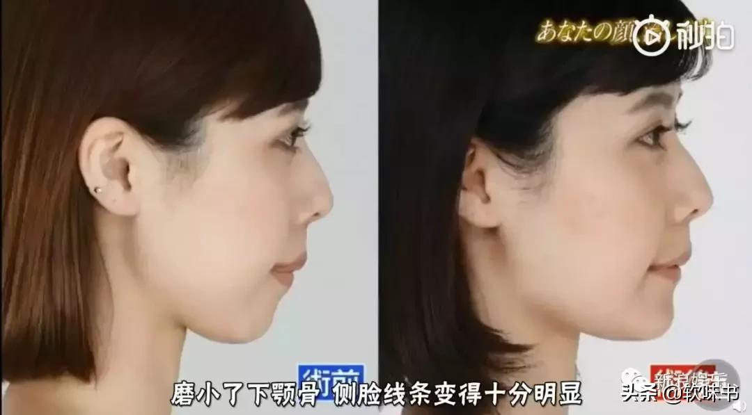 整容脸vs自然脸同龄女星对比,明明是整容脸却没被吐槽过