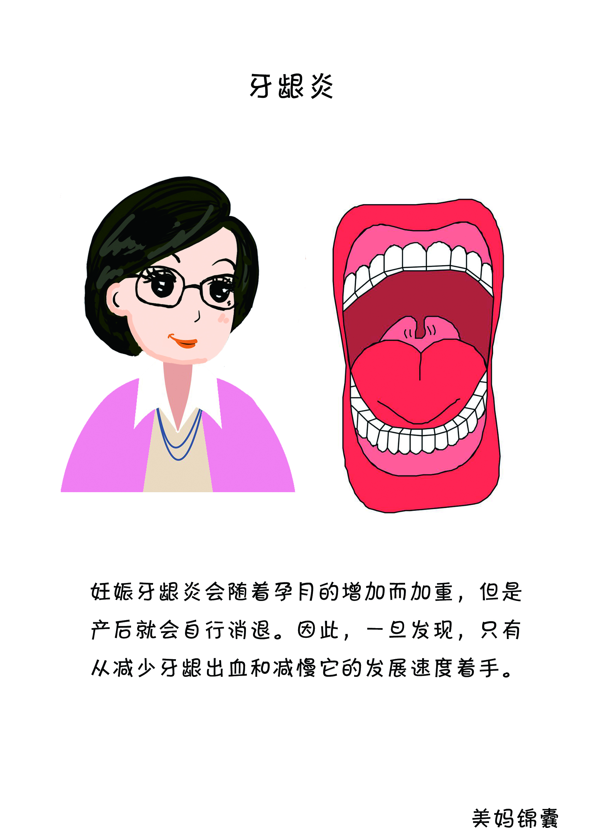 孕期牙龈炎怎么办,孕期牙龈炎使用什么牙膏