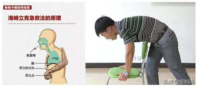 儿童被花生呛到了急救视频,幼儿吃花生被呛进气管急救