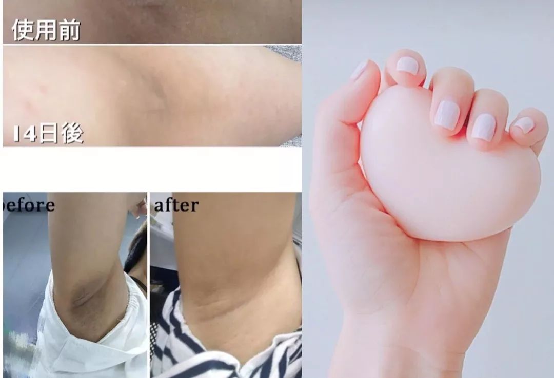 夏日变白神器,夏日必备神器推荐4款