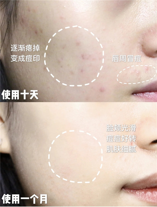 清水和洗面奶洗脸哪个好,用清水洗脸和用洗面奶洗脸的区别