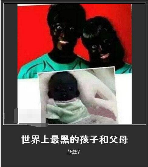 世上最黑的孩子现在怎么样了,世界最黑的小孩现在什么样了