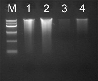 基因组dna提取,基因组dna提取之后怎么检测