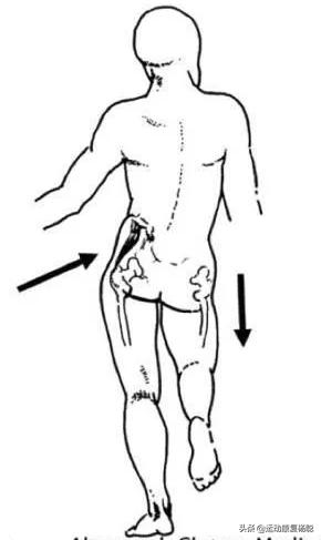 脚踝扭伤长期不好,脚踝扭伤后休息20天怎么康复