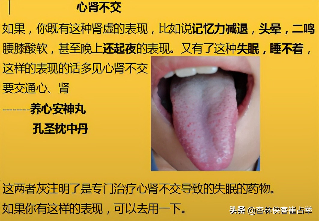 治疗失眠的十种中成药,治疗失眠多梦的中成药大全