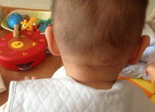 8岁男孩口吐白沫,昏迷入院,医生告知原因,宝爸痛扇自己嘴巴