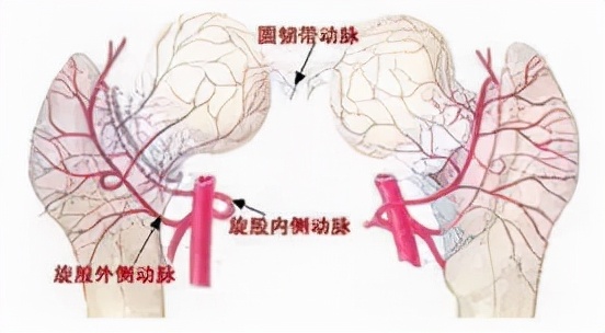 股骨头坏死和腰间盘突出症状区别,椎间盘突出和股骨头坏死症状区别