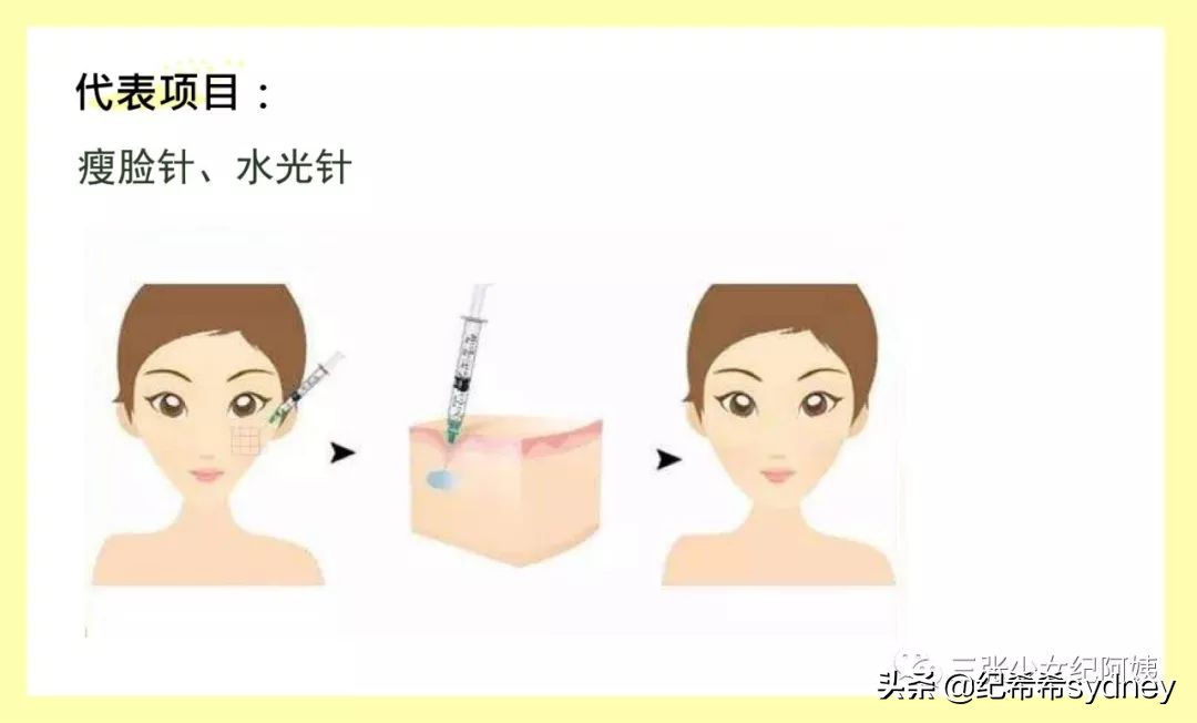 卡戴珊詹娜医美,卡戴珊太后医美