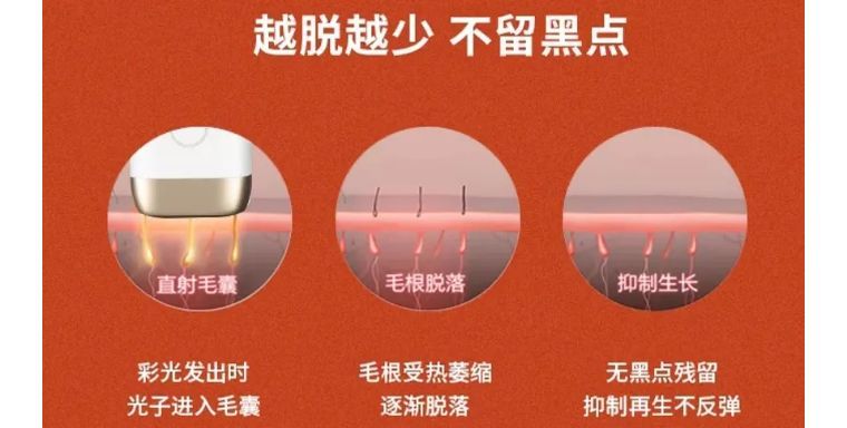 j-style脱毛仪,j-style脱毛仪怎么样