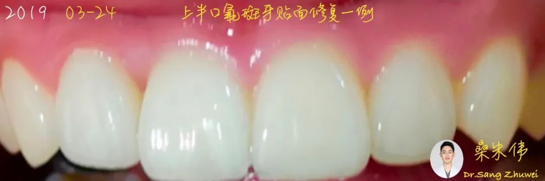 从小白到资深大咖,从小白到大师的蜕变