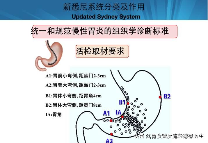 为什么胃炎不能彻底治愈,多年的胃炎怎么治