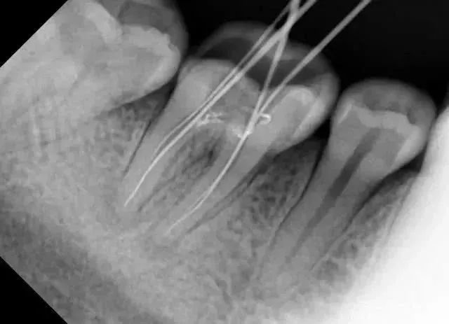 看牙不拍片直接说费用,医院看牙拍片贵吗