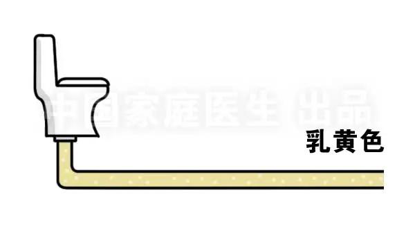 上厕所有四个症状说明肝有问题,上厕所时肾有刺痛是怎么回事