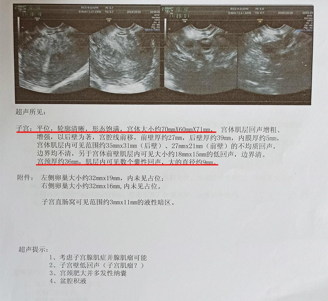 天生的痛经可以做手术根治么,手术根除原发性痛经