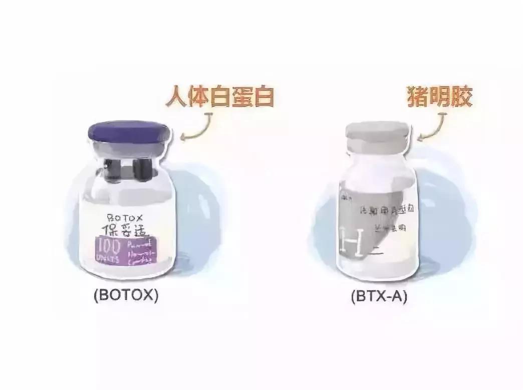 进口瘦脸针和国产瘦脸针区别,国产和进口瘦脸针效果一样吗