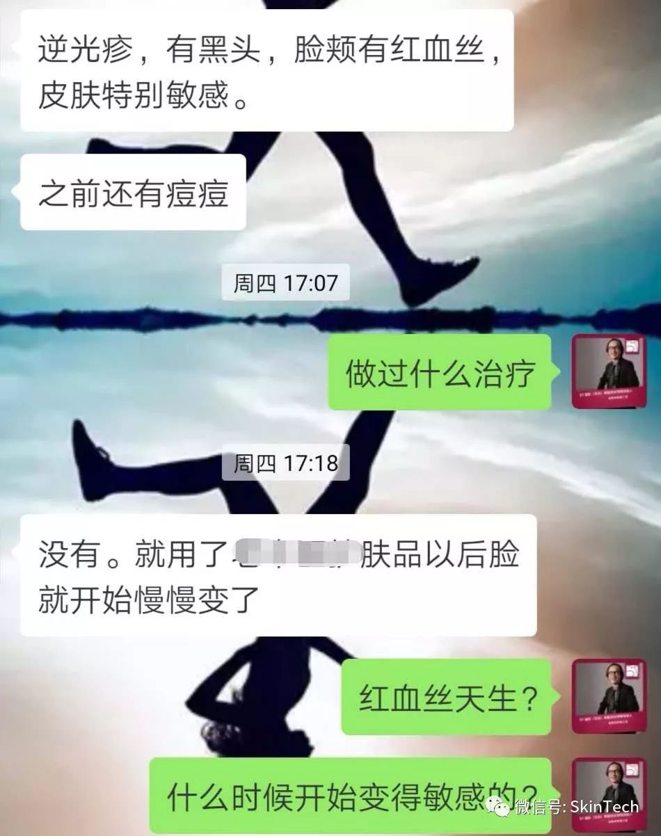 逆光疹是属于皮肤炎症吗,逆光疹是不是日光性皮炎