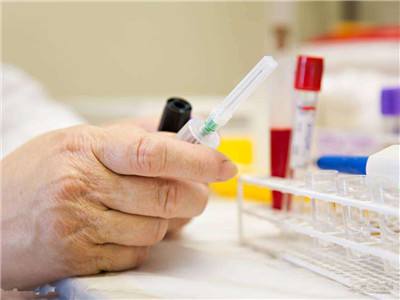 深海鱼油1050降血脂效果怎么样,鱼油真的可以降血脂吗