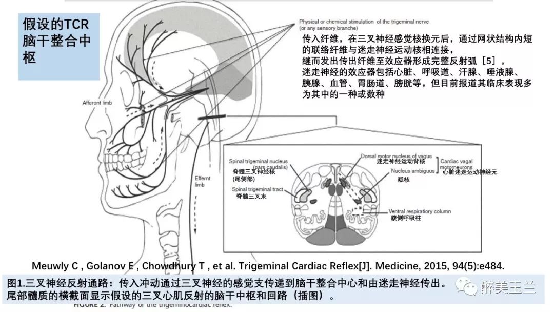 病例分享丨三叉神经节微球囊压迫术的麻醉管理