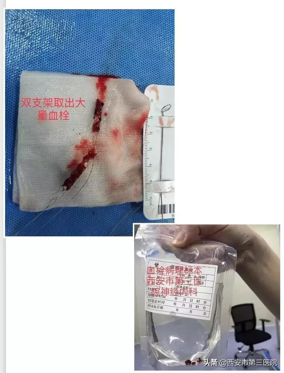 西安市第三医院西北大学附属医院,西北大学附属医院西安市第三医院