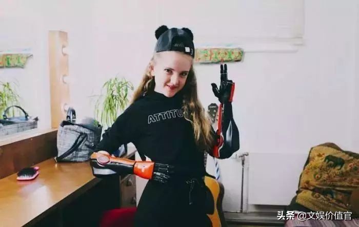 真实版“战斗天使”阿丽塔：13岁机械臂美少女，励志到哭！