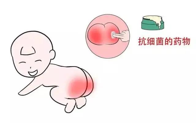 宝宝红屁股怎么护理,宝宝红屁股应该怎么护理