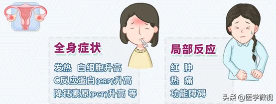 夫妻生活后,女性这种疾病患病率增加!请务必采取这2个健康措施