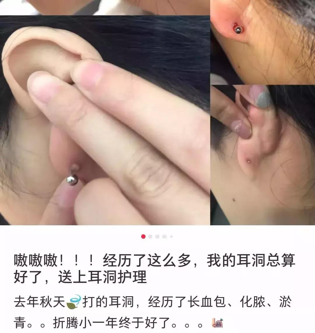 想打耳洞又怕打了不好看,想打耳洞但是怕耳洞长脏东西