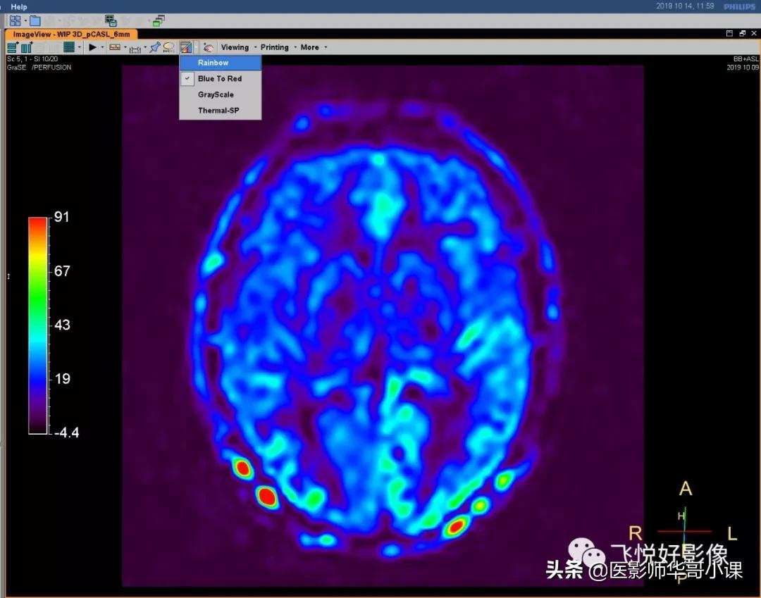 飞利浦磁共振快速扫描方案指南,飞利浦1.5t磁共振各部位扫描技术