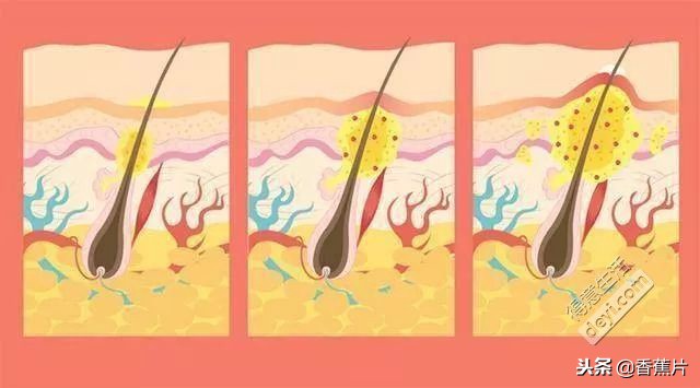 美妆达人教你如何护肤,美妆护肤达人案例